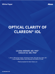 Optical Clarity Of Clareon® IOL