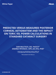 Predicted Versus Measured Posterior Corneal Astigmatism And The Impact On Toric IOL Power Calculations In Standard Cataract Surgery