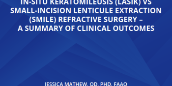 Topography-guided Laser Assisted In-situ Keratomileusis (Lasik) vs Small-incision Lenticule Extraction (Smile) Refractive Surgery