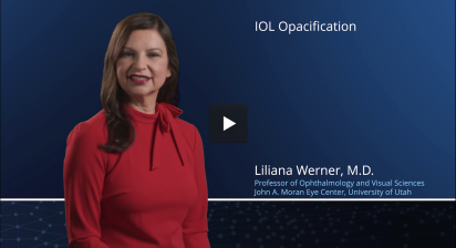 IOL Opacification